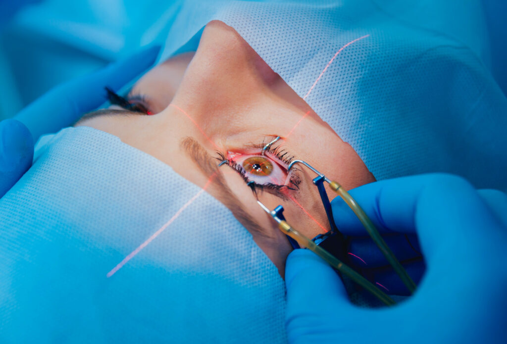 Myopia (Short-Sightedness) Eye Surgery
