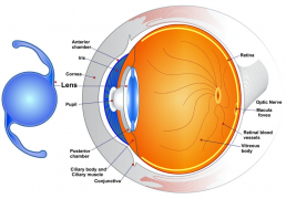 Cataract Surgery Cincinnati _ Refractive Lens Replacement Oxford